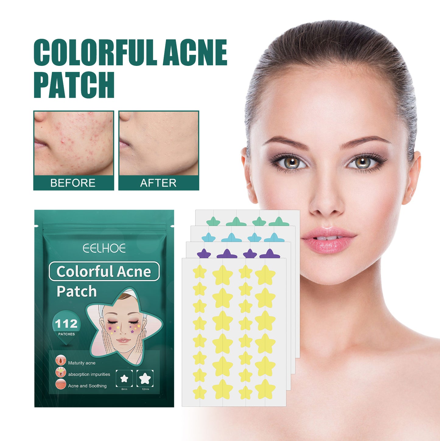 Eelhoe Star Acne Patch – Salicylic Acid & Tea Tree Oil Acne Treatment
