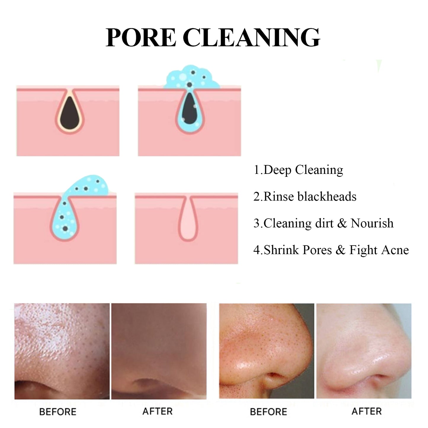 EELHOE Blackhead Removal Mask Deeply Cleanses Pores, Lightening Blackheads, Oil Control And Moisturizing Smear Peel Mask