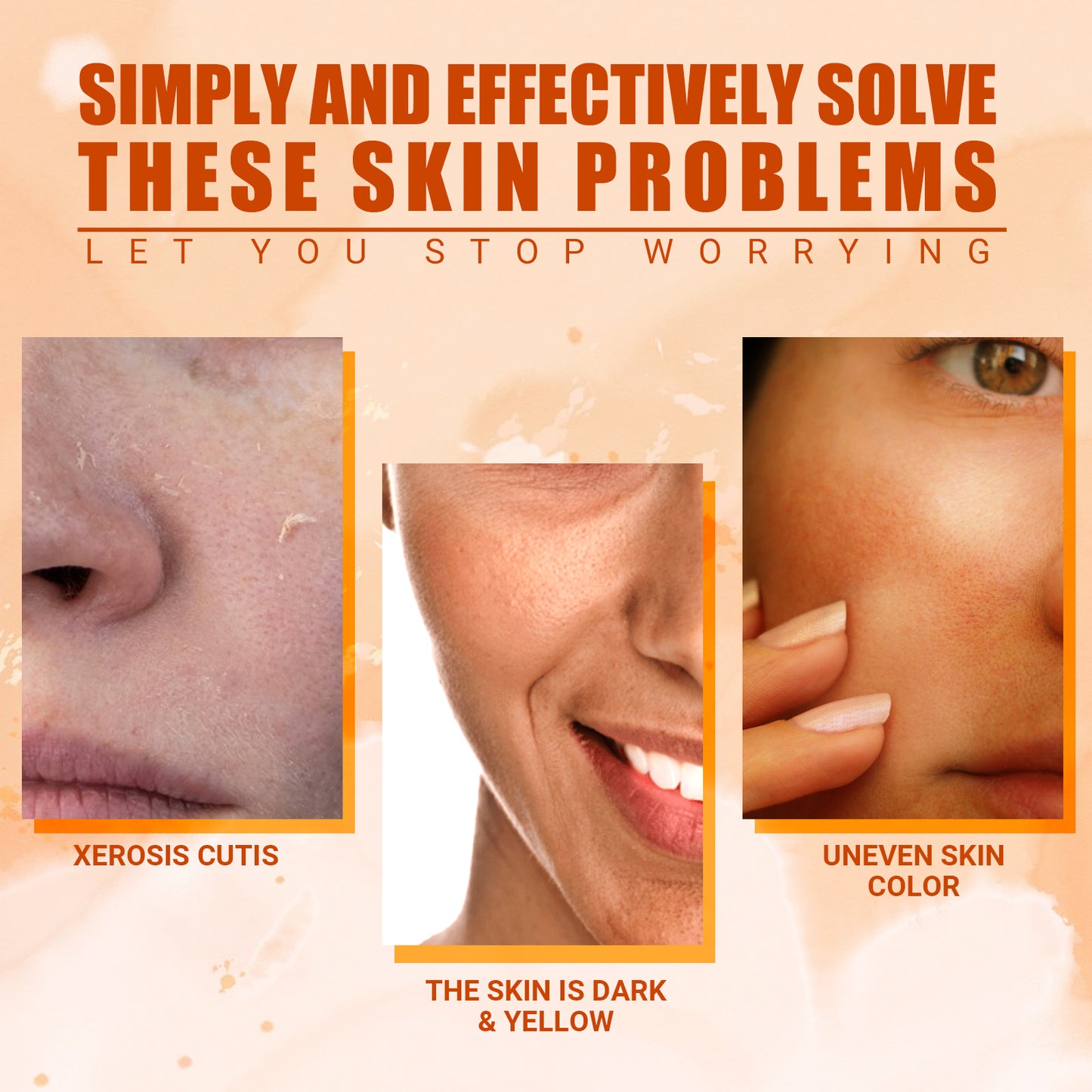 Vitamin C Moisturizing Spray – Hydrates, Lightens Acne Spots & Whitens
