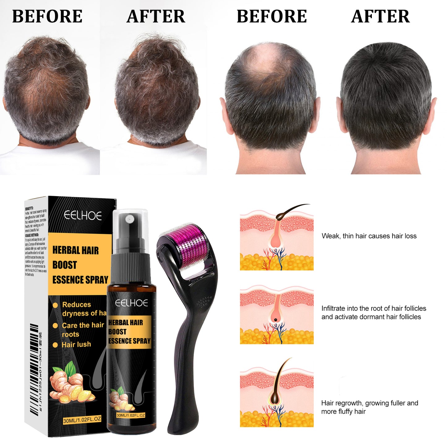 Herbal Hair Essence Spray,Prevent Falling Hair And Scalp Moisturizing And Nourishing Solution