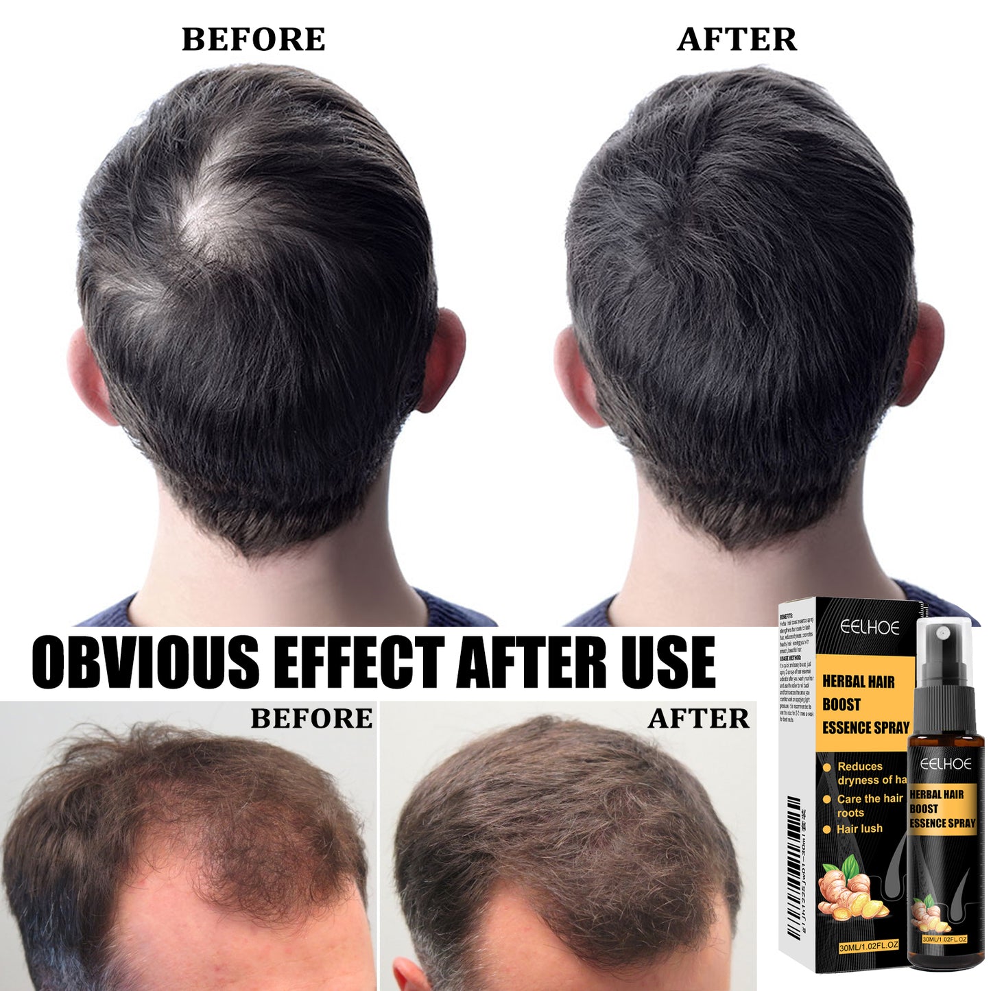 Herbal Hair Essence Spray,Prevent Falling Hair And Scalp Moisturizing And Nourishing Solution