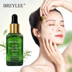 BREYLEE Acne Treatment Serum Mask – Anti-Acne & Pimple Scar Remover