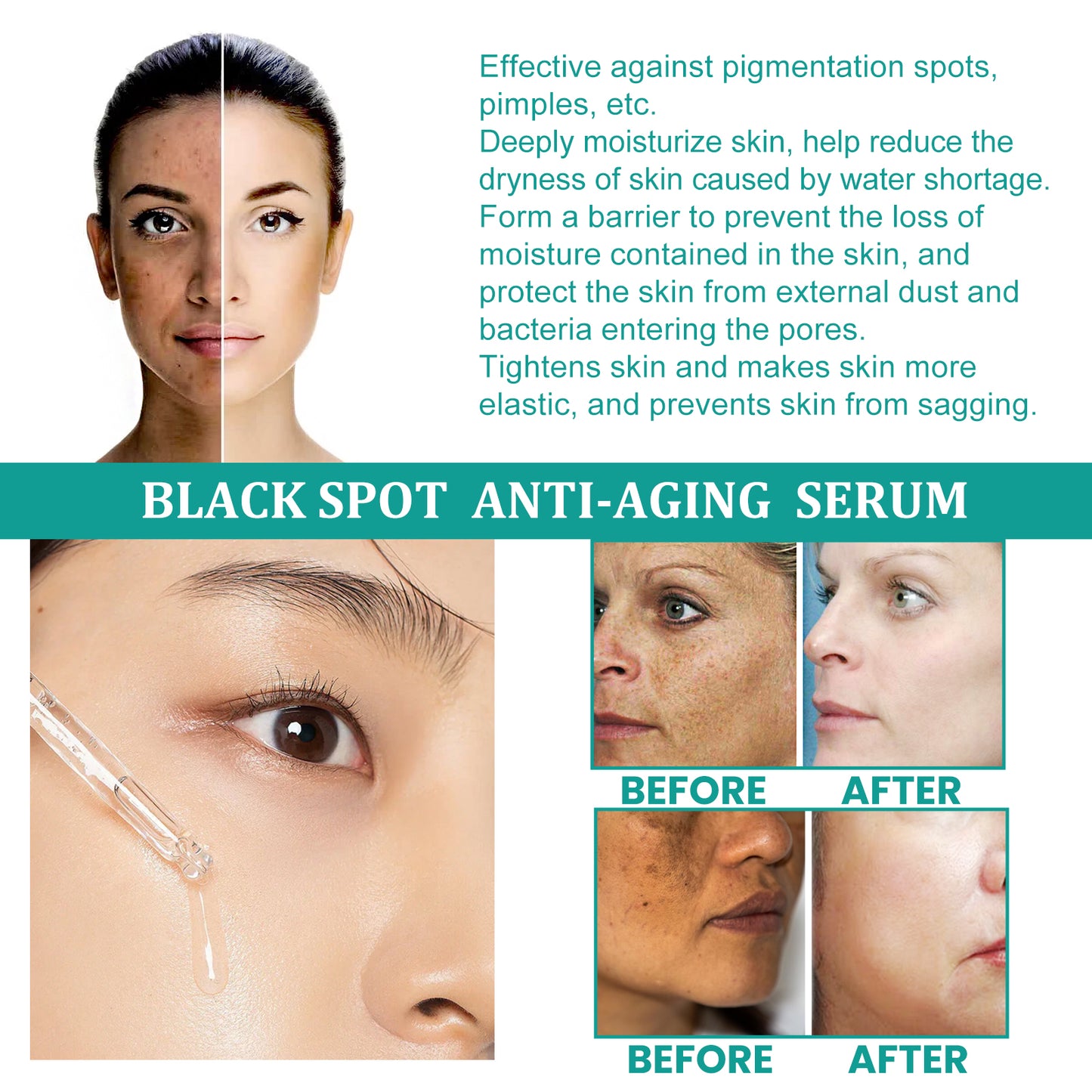 Eelhoe Dark Spot Serum – Brightening, Moisturizing & Anti-Aging