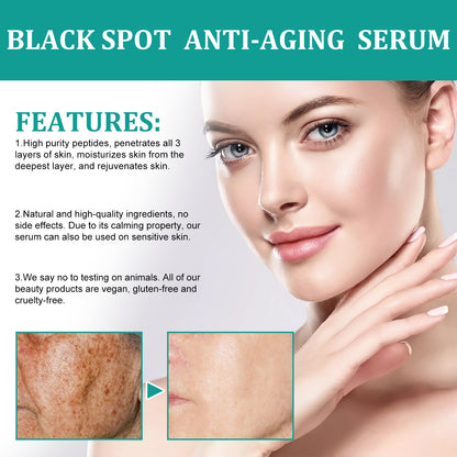Eelhoe Dark Spot Serum – Brightening, Moisturizing & Anti-Aging
