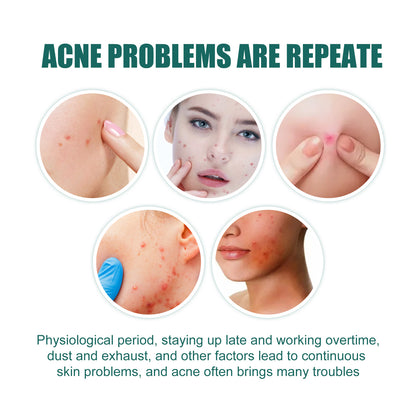 Eelhoe Star Acne Patch – Salicylic Acid & Tea Tree Oil Acne Treatment